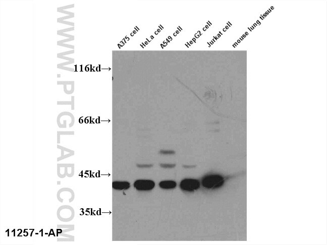 ERK1-Antibody-11257-1-AP-A399WB.jpg
