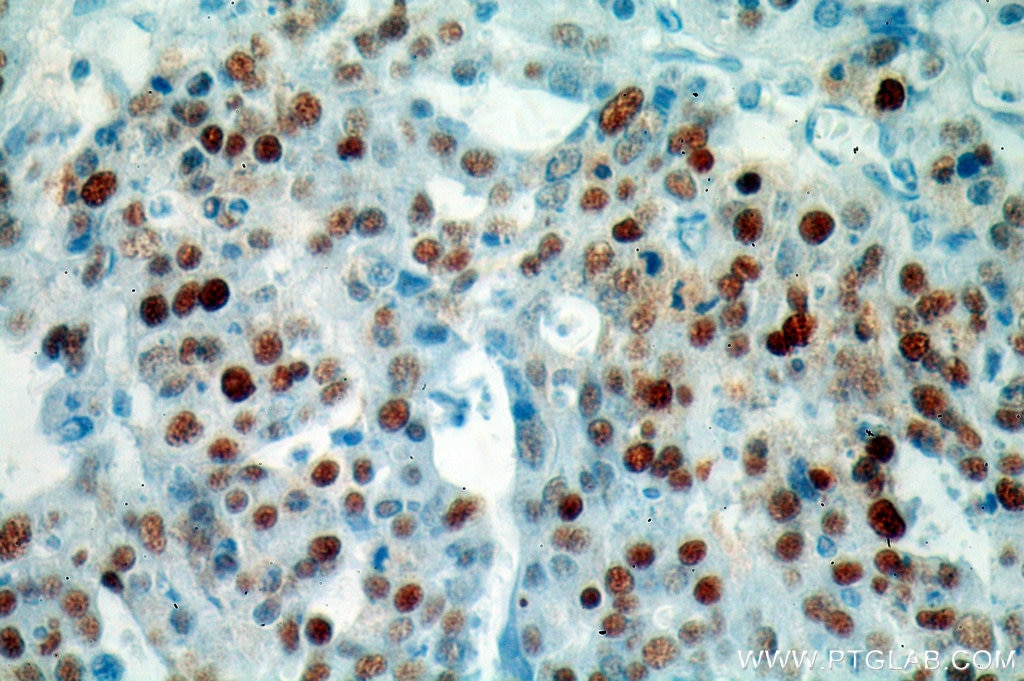 p53 antibody