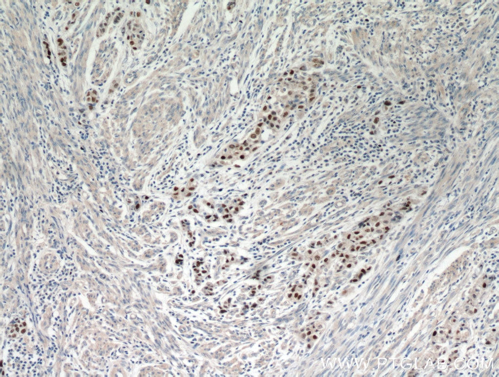 p53 antibody