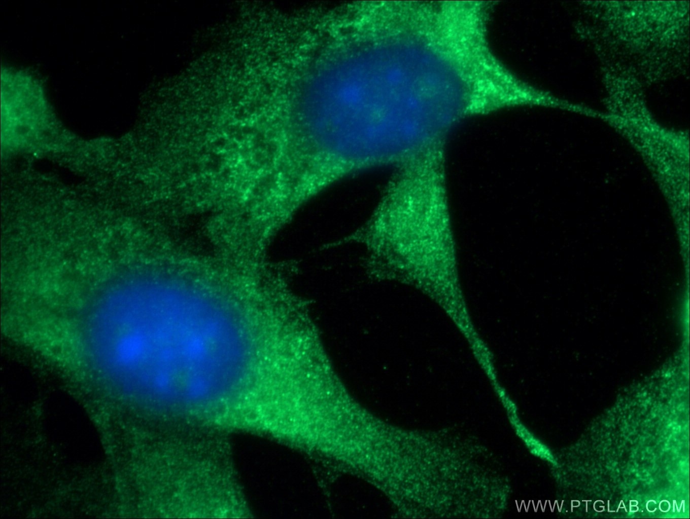 Protein Kinase C Zeta Antibodies