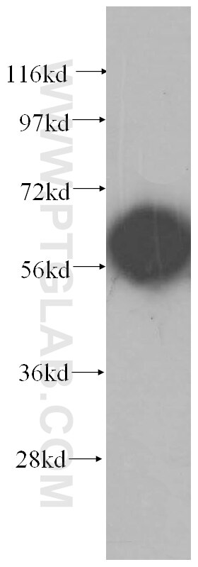 CCT8 Antibody 12263 1 AP Proteintech