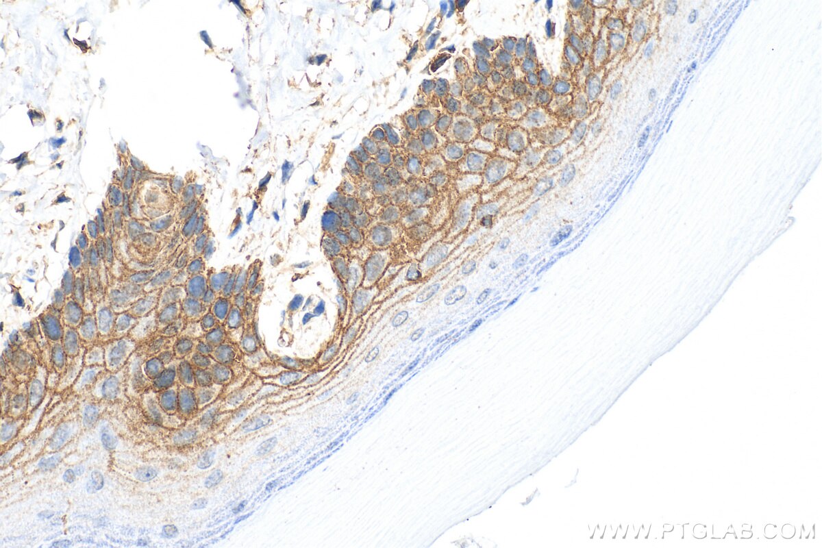 Cd Antibody Ap Proteintech