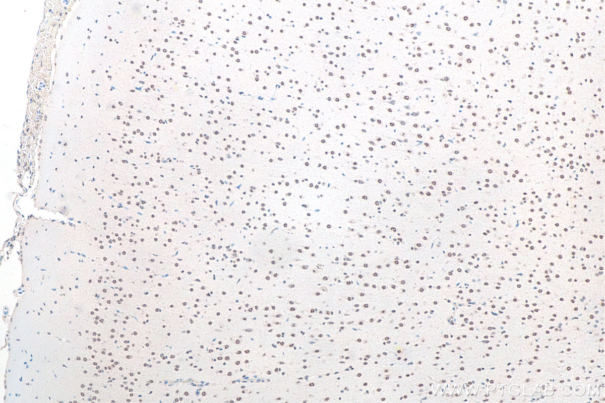Immunohistochemistry (IHC) staining of rat brain tissue using FUS/TLS Polyclonal antibody (11570-1-AP)