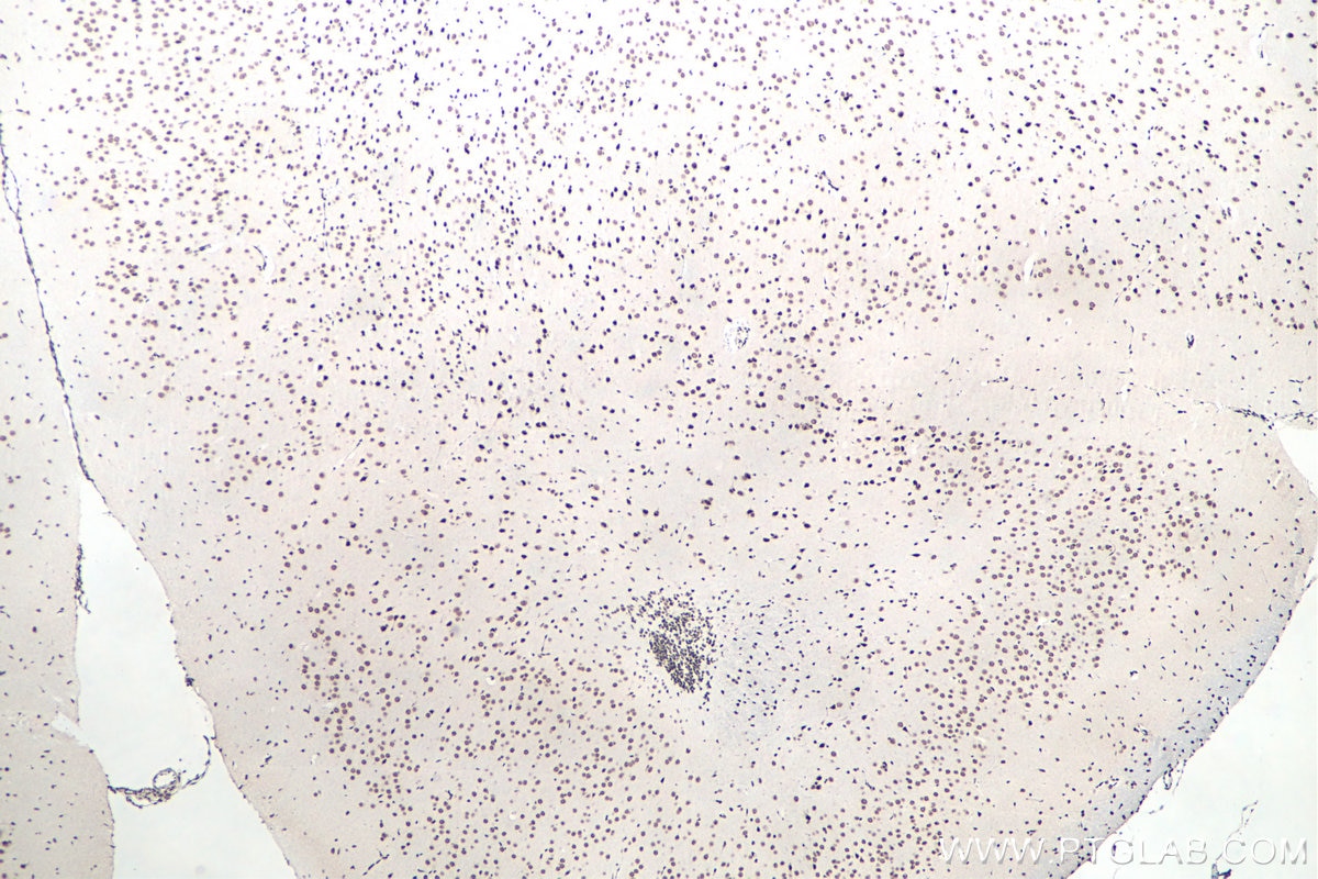 Immunohistochemistry (IHC) staining of mouse brain tissue using FUS/TLS Polyclonal antibody (11570-1-AP)