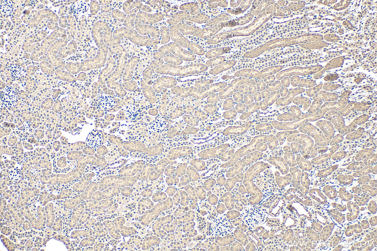 Immunohistochemistry (IHC) staining of mouse kidney tissue using MLYCD Polyclonal antibody (15265-1-AP)