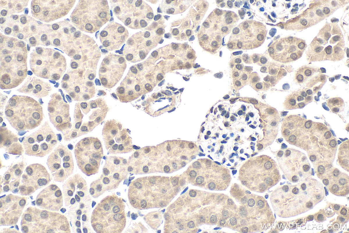 Immunohistochemistry (IHC) staining of mouse kidney tissue using MLYCD Polyclonal antibody (15265-1-AP)