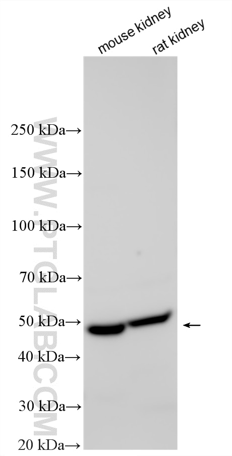 Western Blot (WB) analysis of various lysates using MLYCD Polyclonal antibody (15265-1-AP)
