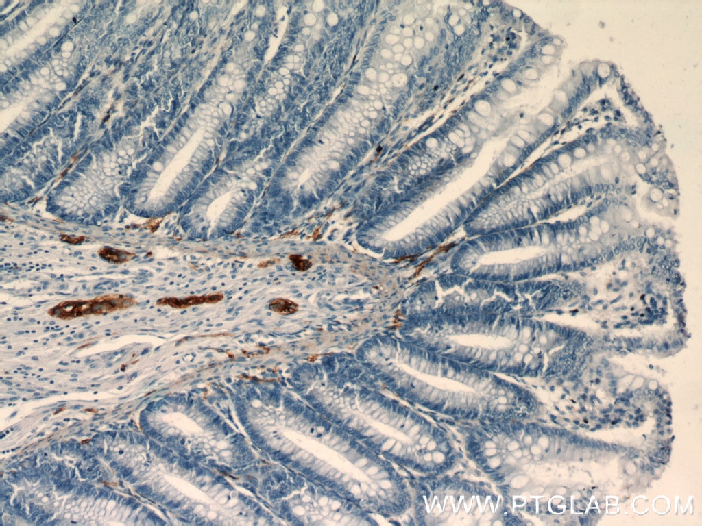 IHC staining of paraffin-embedded human colon slide using NCAM1 antibody (14255-1-AP) at a dilution of 1:400