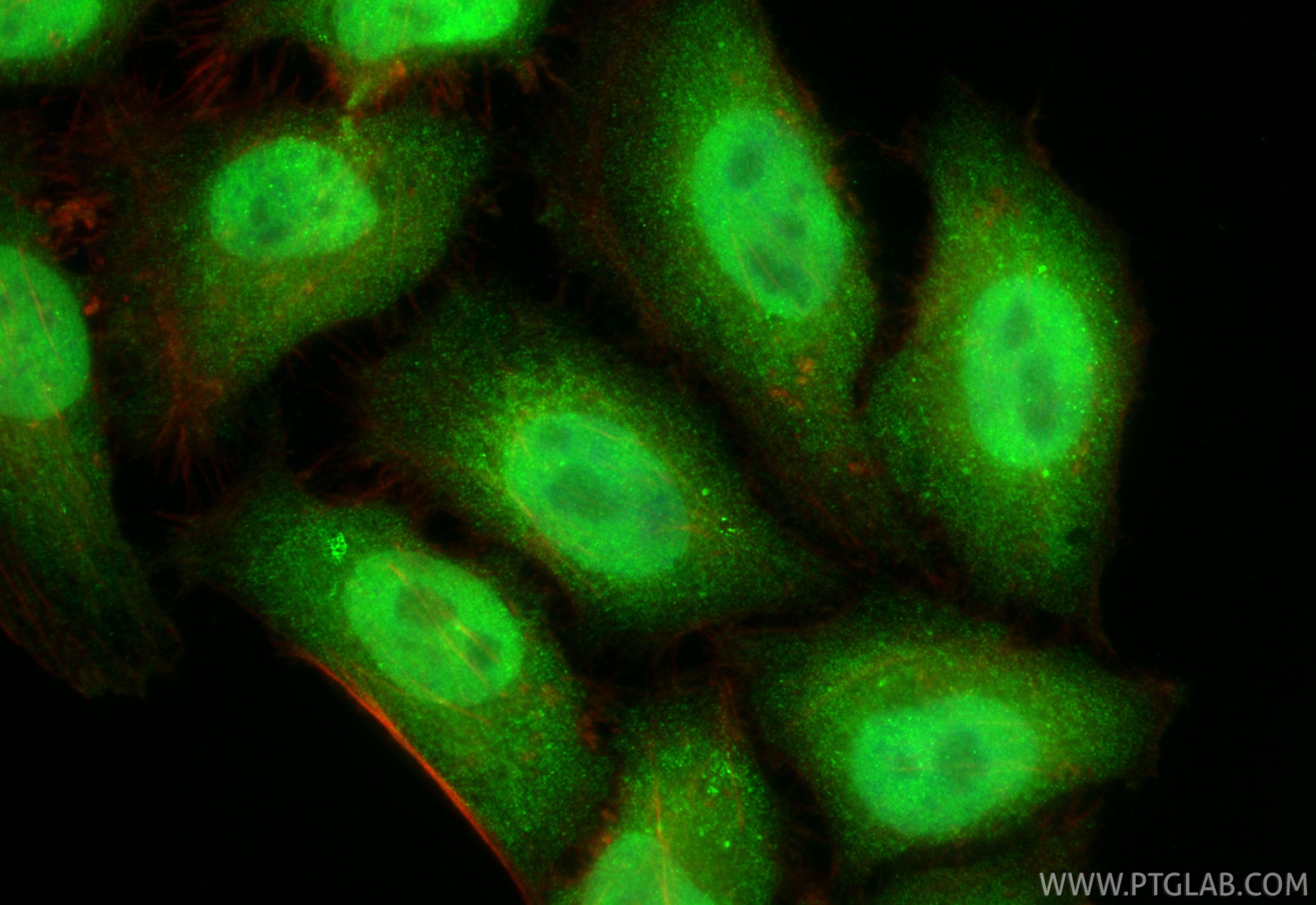 Immunofluorescence (IF) / fluorescent staining of HepG2 cells using TIPE2/TNFAIP8L2 Polyclonal antibody (15940-1-AP)
