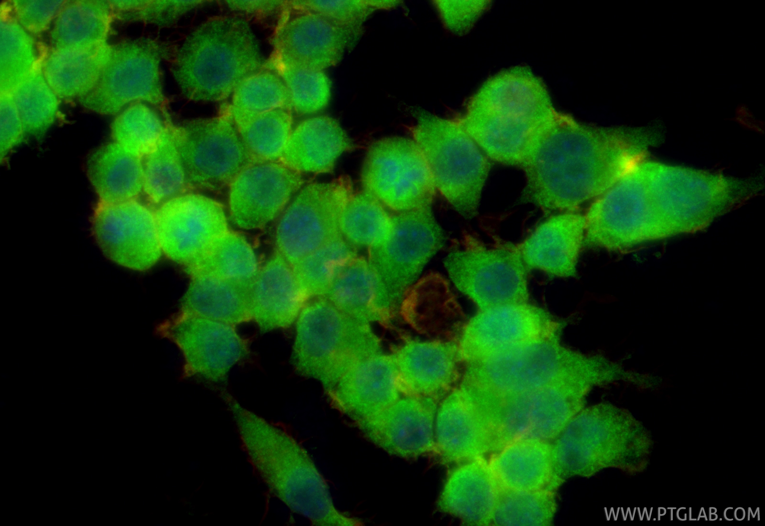 Immunofluorescence (IF) / fluorescent staining of RAW 264.7 cells using TIPE2/TNFAIP8L2 Polyclonal antibody (15940-1-AP)
