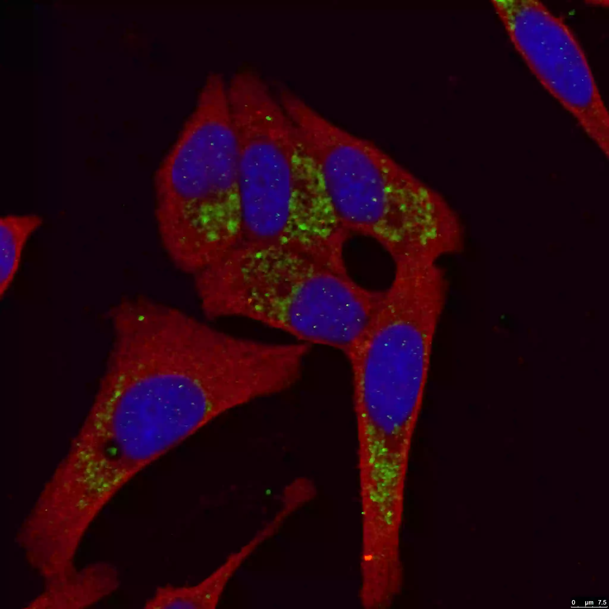 Immunofluorescence (IF) staining of HepG2 cells using a LC3b antibody 18725-1-AP