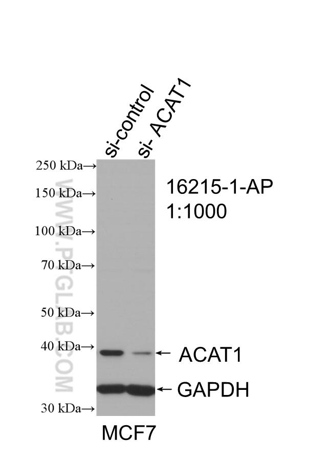 WB analysis of MCF-7 cells using 16215-1-AP