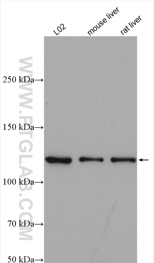 WB analysis of L02 cells using 15421-1-AP