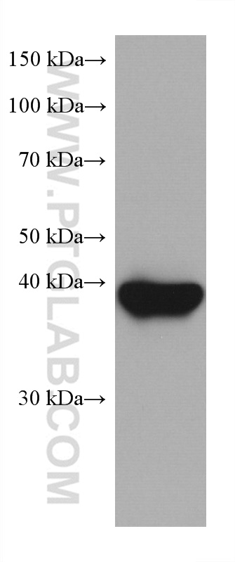 ANKRD1 antibody (67775-1-Ig) | Proteintech