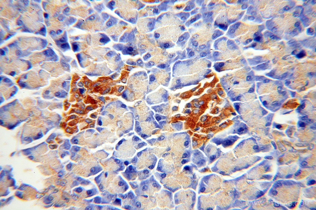 IHC staining of paraffin-embedded human pancreas using ATP6V1A antibody (17115-1-AP) at a dilution of 1:100 (40x objective)