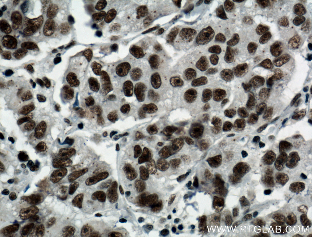 BCAS2 antibody (10414-1-AP) | Proteintech