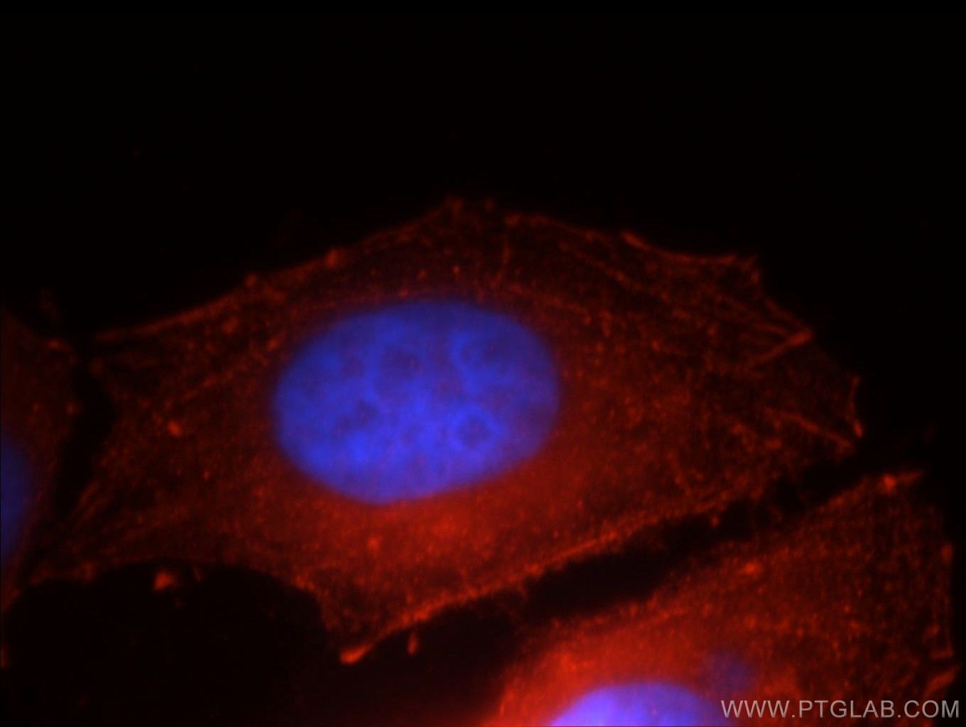 Immunofluorescent analysis of HepG2 cells using E-Cadherin (20648-1-AP) antibody at a dilution of 1:25 and Rhodamine-labelled goat anti-rabbit IgG (red), DAPI (blue).