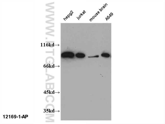 CHFR-Antibody-12169-1-AP-A208WB.jpg