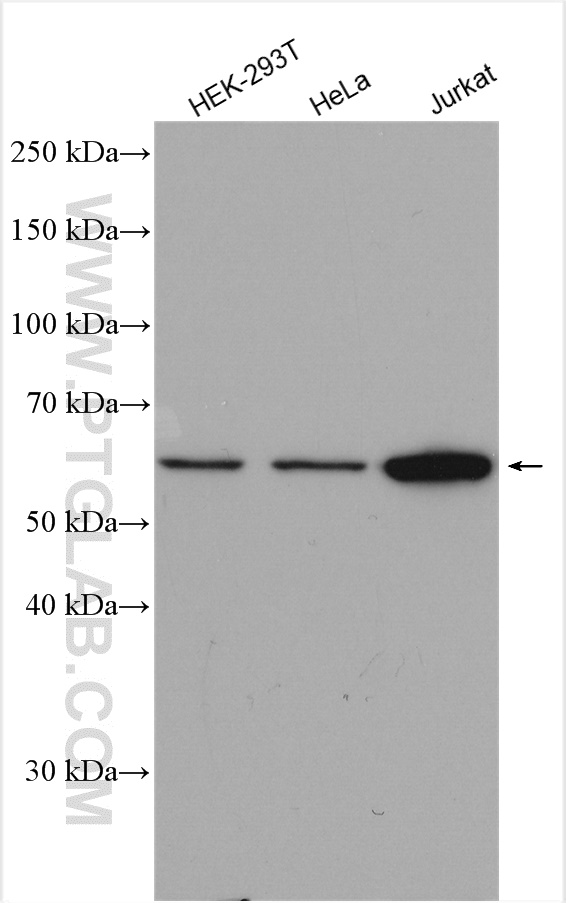 Chmp7 Antibody 16424 1 Ap Proteintech