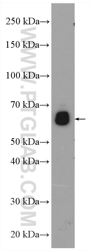 Chmp7 Antibody 16424 1 Ap Proteintech