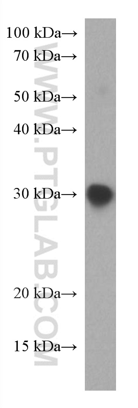 Sars Cov 2 Spike Glycoprotein 319 541 Aa Antibody 67758 1 Ig Proteintech