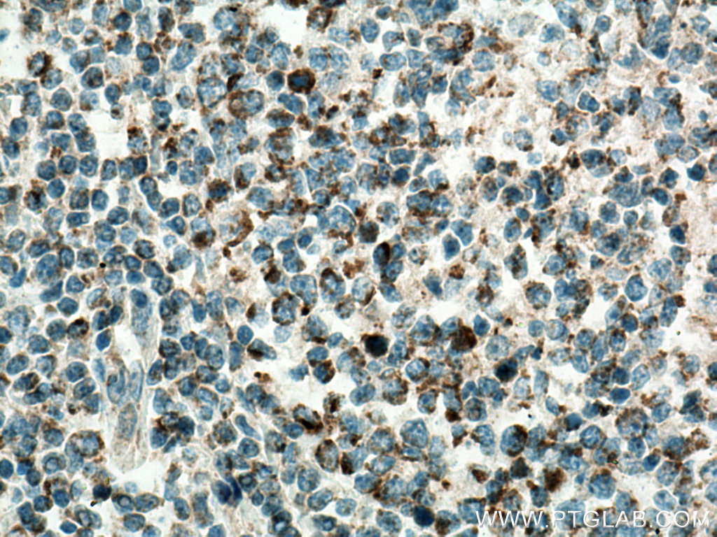 Cxcr4 Antibody 60042 1 Ig Proteintech