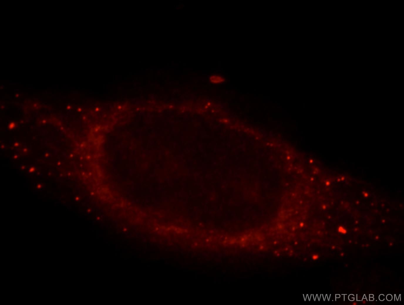 CYP3A4 Antibody 18227-1-AP | Proteintech