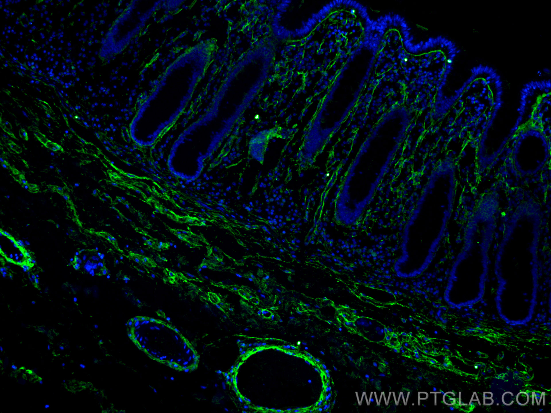 Collagen Type I antibody (67288-1-Ig) | Proteintech