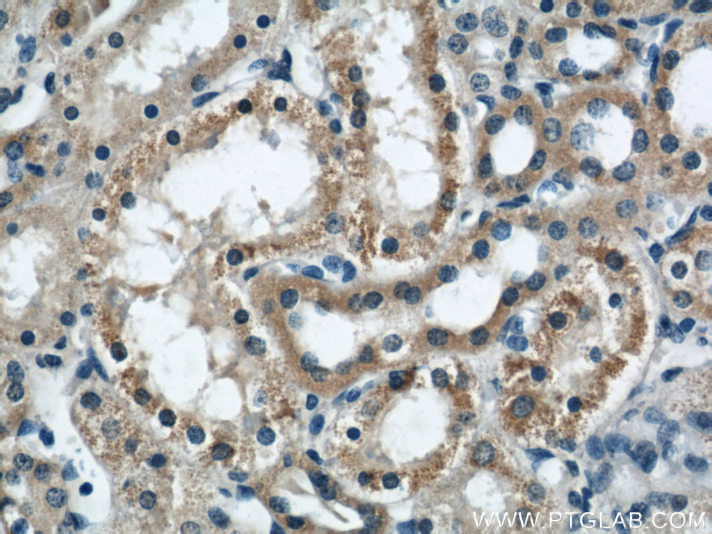 DIO1 antibody (11790-1-AP) | Proteintech