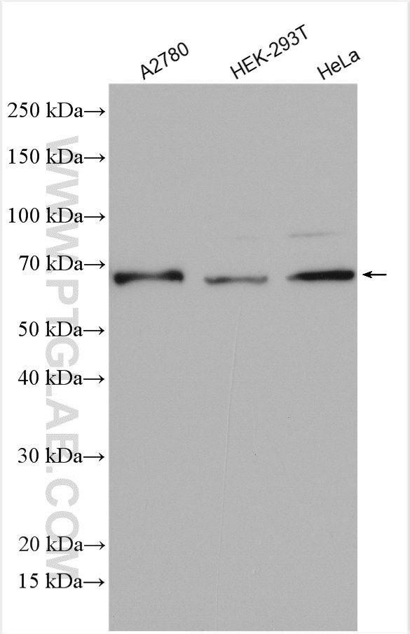 DIS3L2 antibody (28816-1-AP) | Proteintech