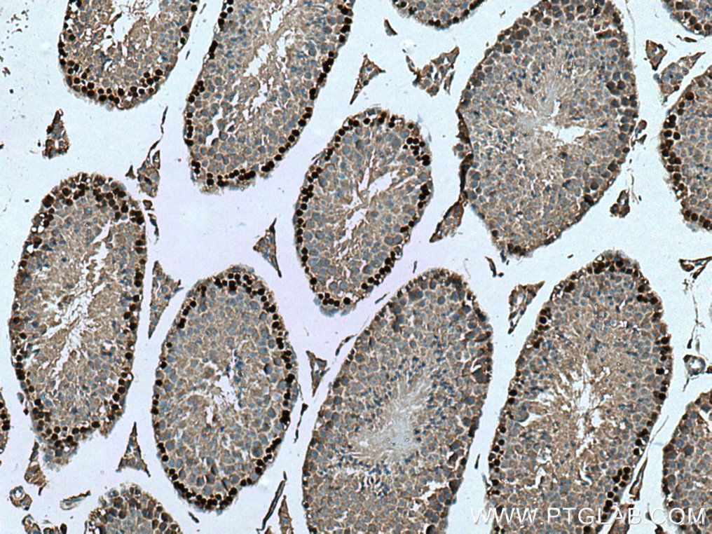 DMC1 antibody (67176-1-Ig) | Proteintech