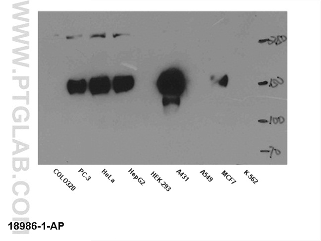 EGFR-Specific-Antibody-18986-1-AP-A101WB.jpg