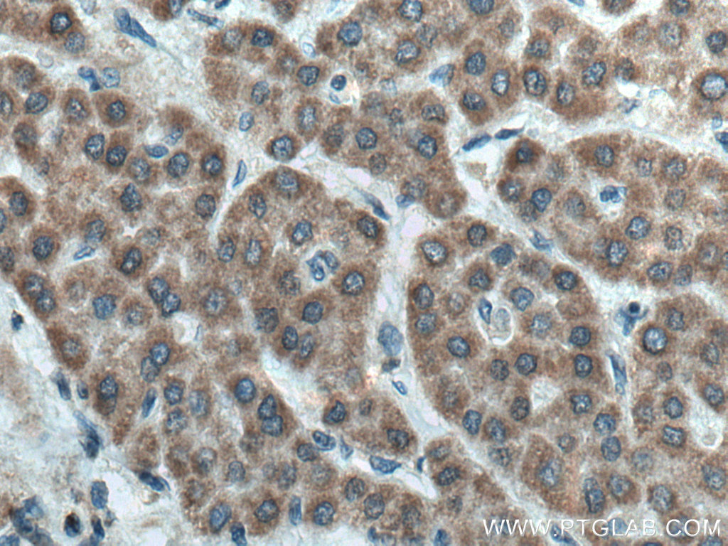 FDXR antibody (15584-1-AP) | Proteintech