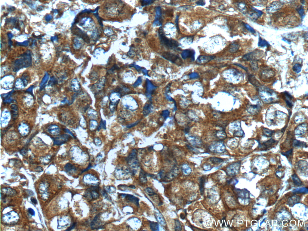 Fgfr2 Antibody 13042 1 Ap Proteintech