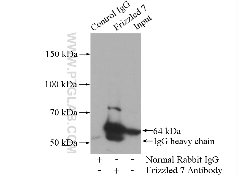 Frizzled 7 Antibody 1 Ap Proteintech