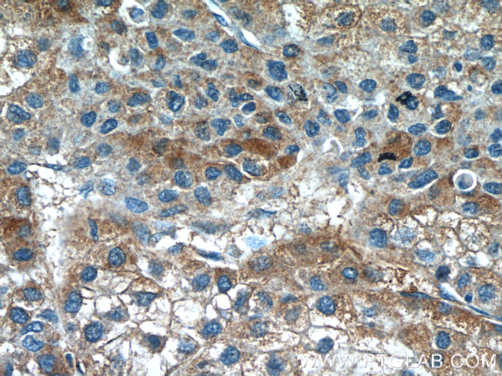 GTSE1 antibody (21319-1-AP) | Proteintech