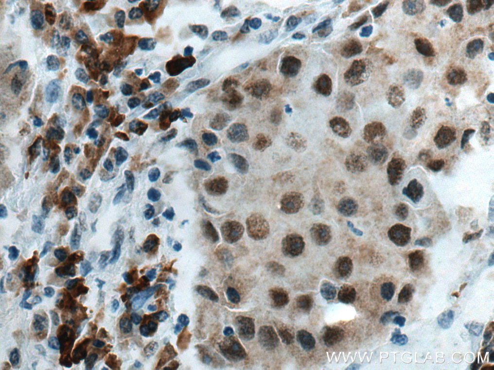 HDAC2 antibody (67165-1-Ig) | Proteintech