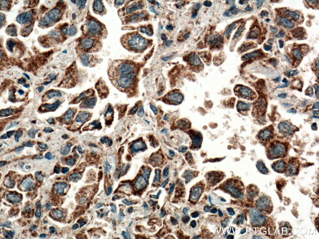 HYAL2 antibody (15115-1-AP) | Proteintech