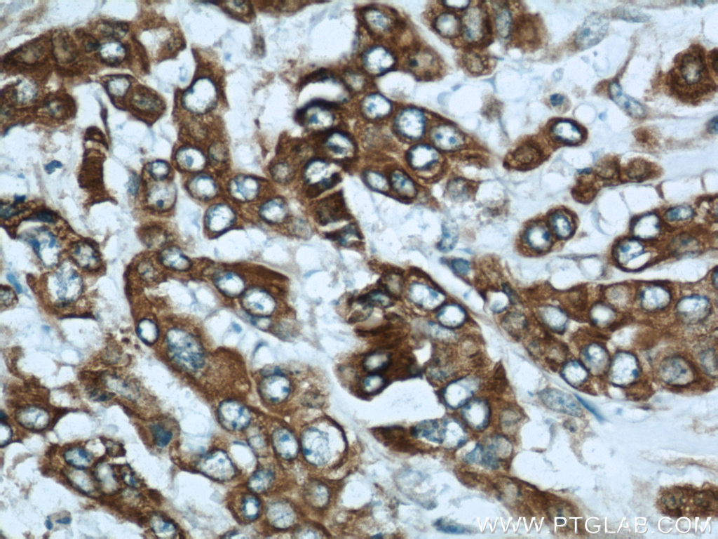 Cytokeratin 18 Antibody 18708-1-ap 