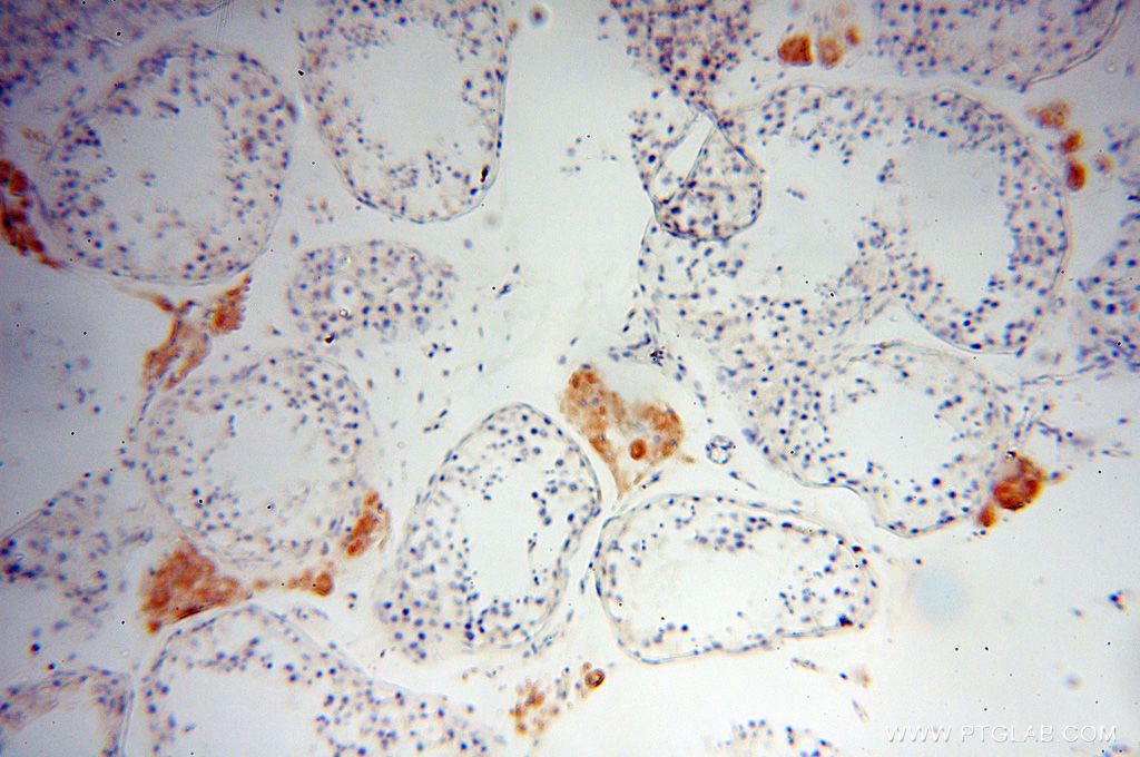 IHC of paraffin-embedded human testis using 16178-1-AP (Lin28B-specific antibody) at a dilution of 1:50 (under 10x lens)