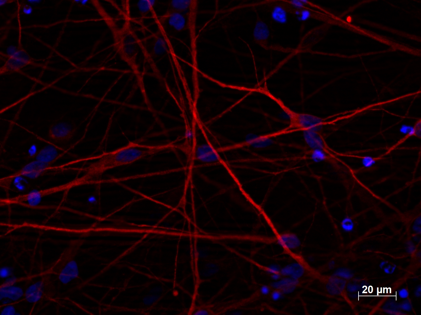 IF staining of MAP2 (17490-1-AP, 1:250 dilution) with 4% PFA fixed control hiPSC derived neuronal cultures (35 days old). (RED MAP2; Blue: DAPI). Provided by BioTalentum Ltd., Hungary