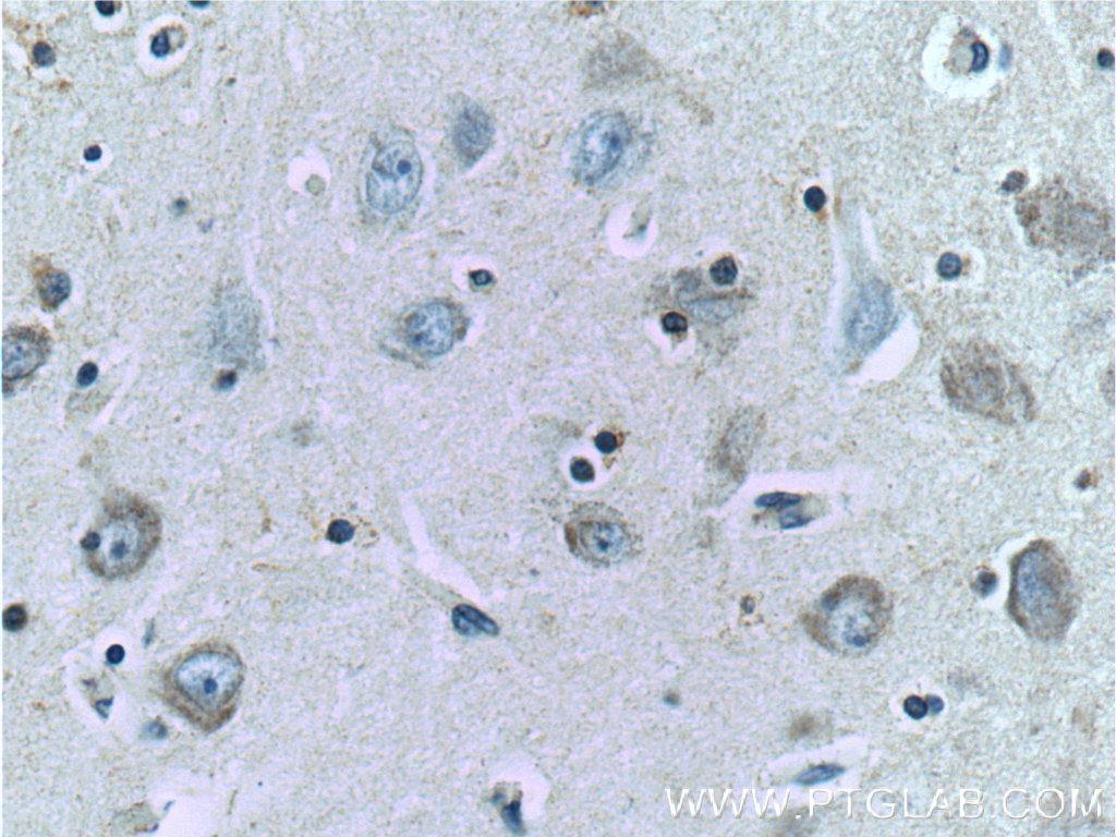 IHC of paraffin-embedded human brain tissue slide using TAU antibody, 10274-1-AP