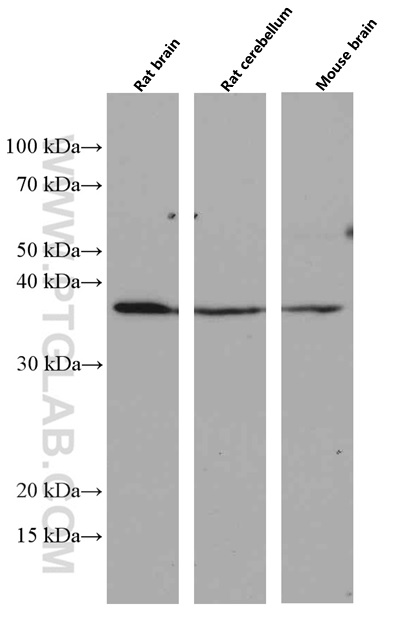 Various tissues were subjected to SDS PAGE followed by western blot with 66513-1-Ig (anti-OLIG2 antibody) at dilution of 1:3000 incubated at room temperature for 1.5 hours