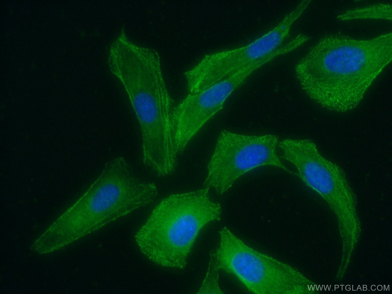 Pdlim7 Antibody 10221 1 Ap Proteintech