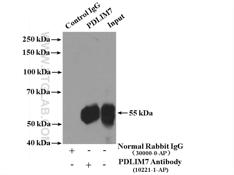 Pdlim7 Antibody 10221 1 Ap Proteintech