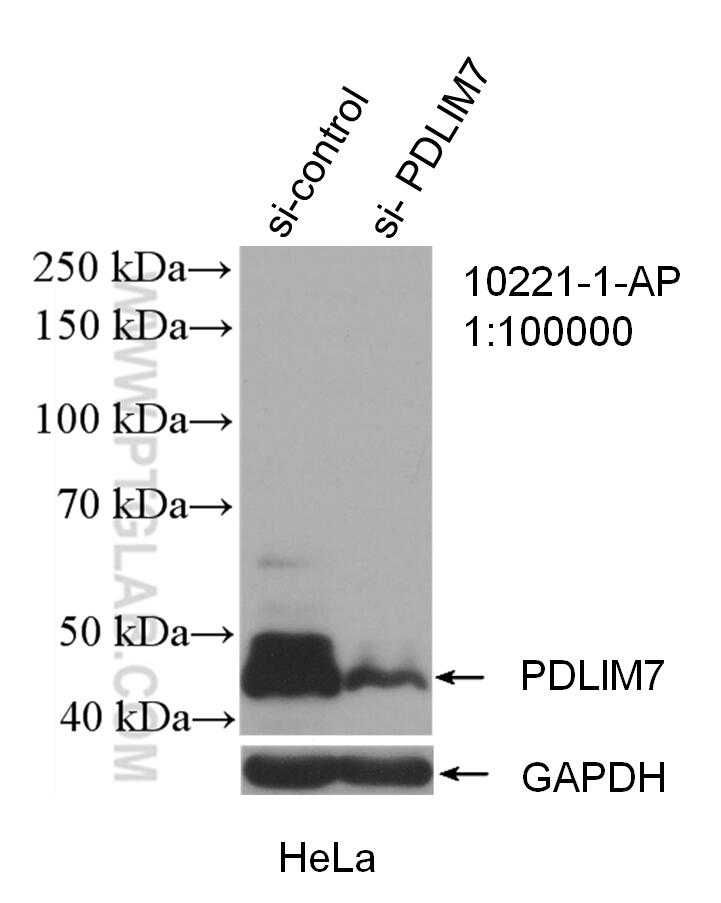 Pdlim7 Antibody 10221 1 Ap Proteintech