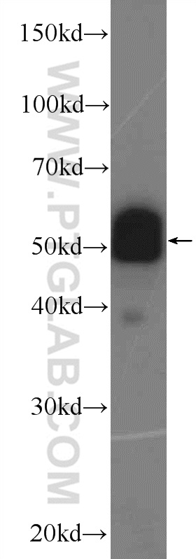 Pdlim7 Antibody 10221 1 Ap Proteintech