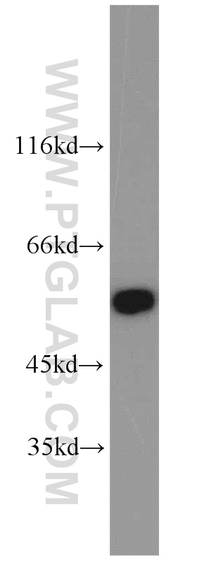 Pdlim7 Antibody 10221 1 Ap Proteintech