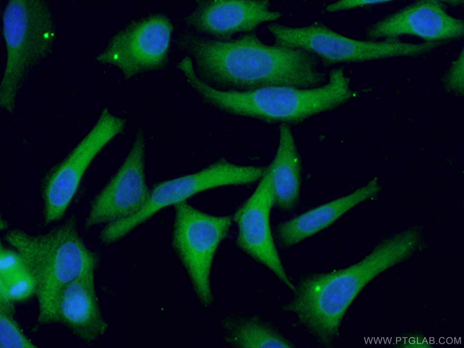 Tgfb signaling