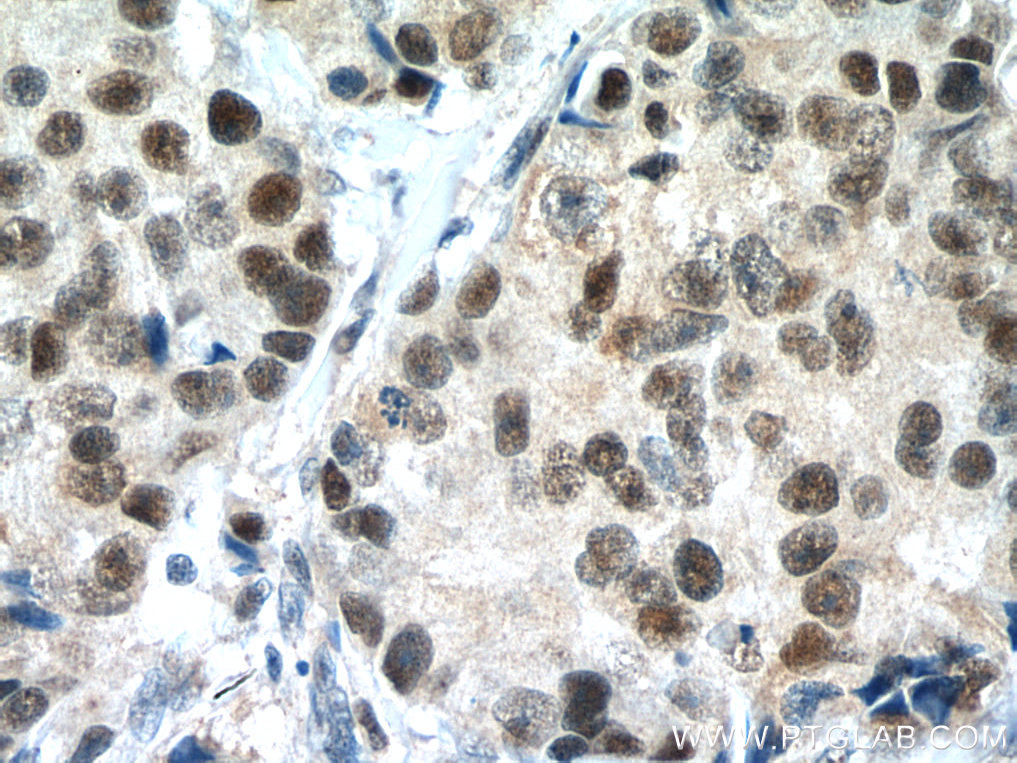 POLD1 antibody (15646-1-AP) | Proteintech